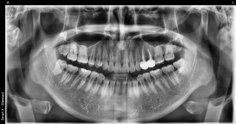 Found a Dental Clinic That Can See Patients on Sundays! Convenient for Patients with Rhinitis and Asthma image 1