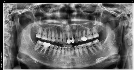 Key Criteria to Know Before Comparing Laminate Prices | OBZERO image 7