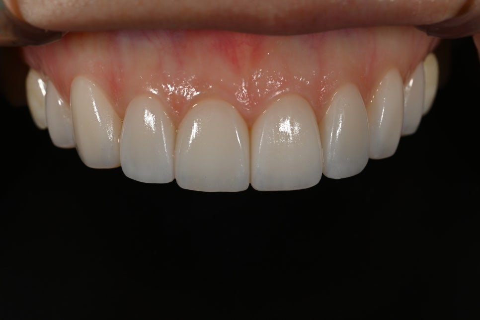 Why Obzero Laminates Look Naturally Beautiful image 17