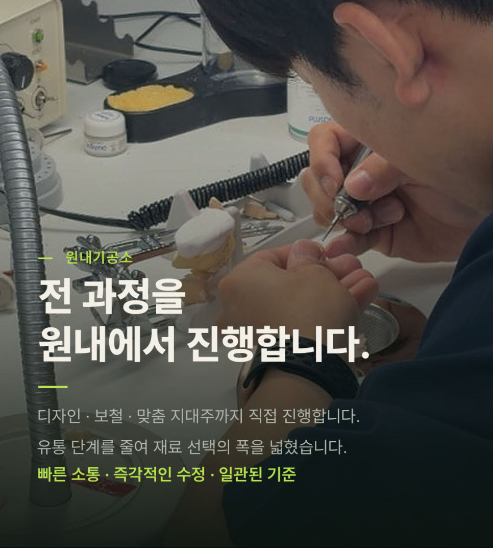 반대교합 있어도 라미네이트 가능할까요? 관련 이미지 7