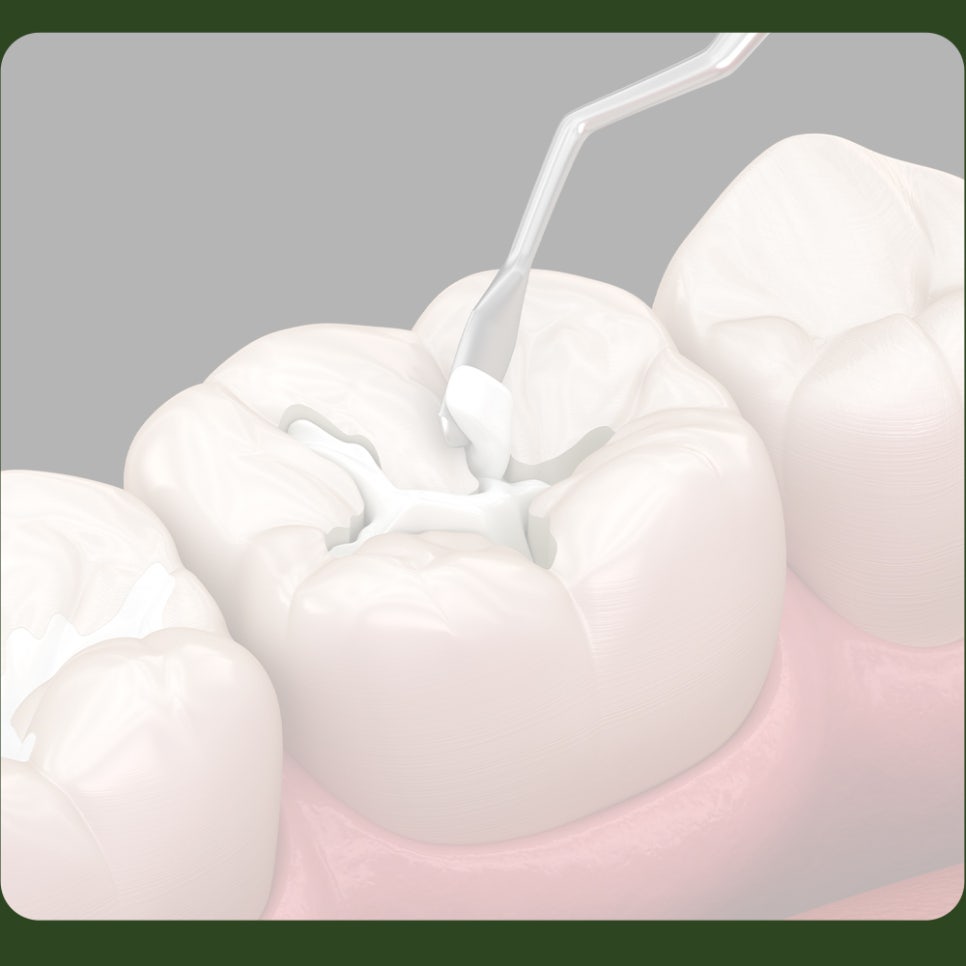 Causes of Resin Discoloration: Let’s Learn Together! image 2