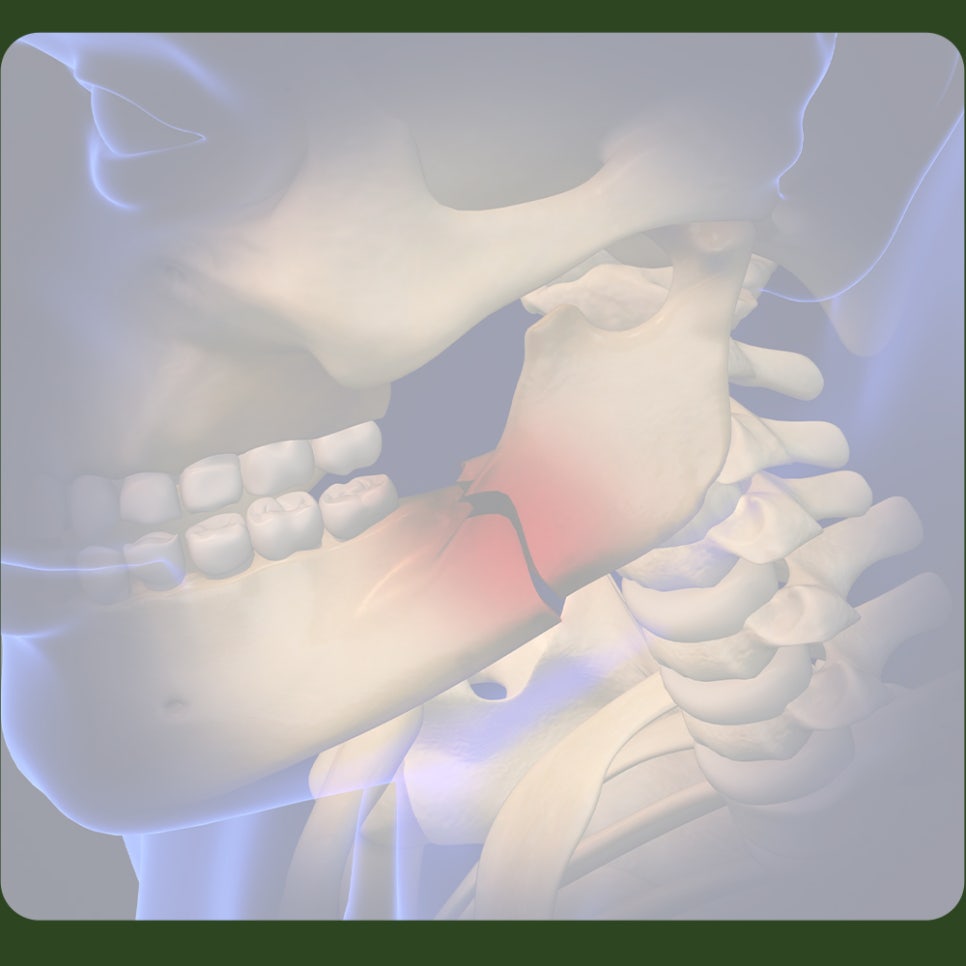 If Your Jaw Is Fractured, What Should You Do? image 2