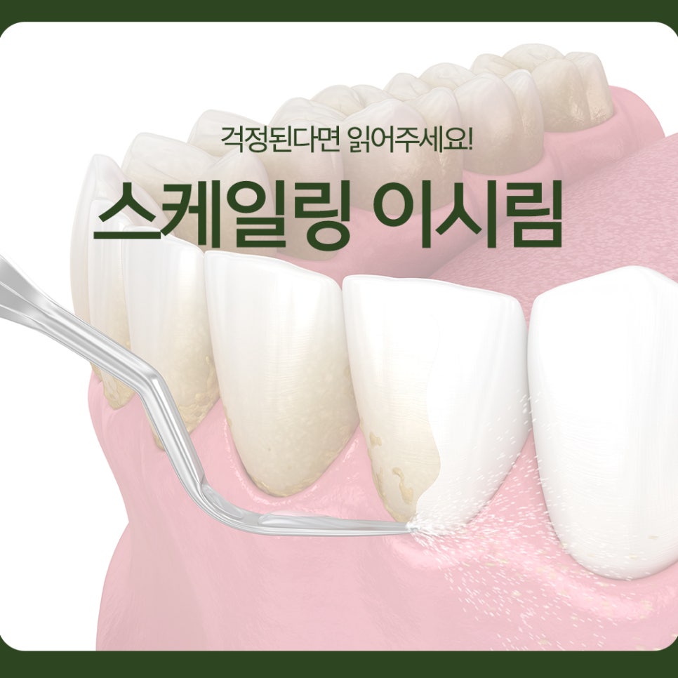 Scaling Sensitivity in Teeth: Please Read This if You’re Worried! image 1