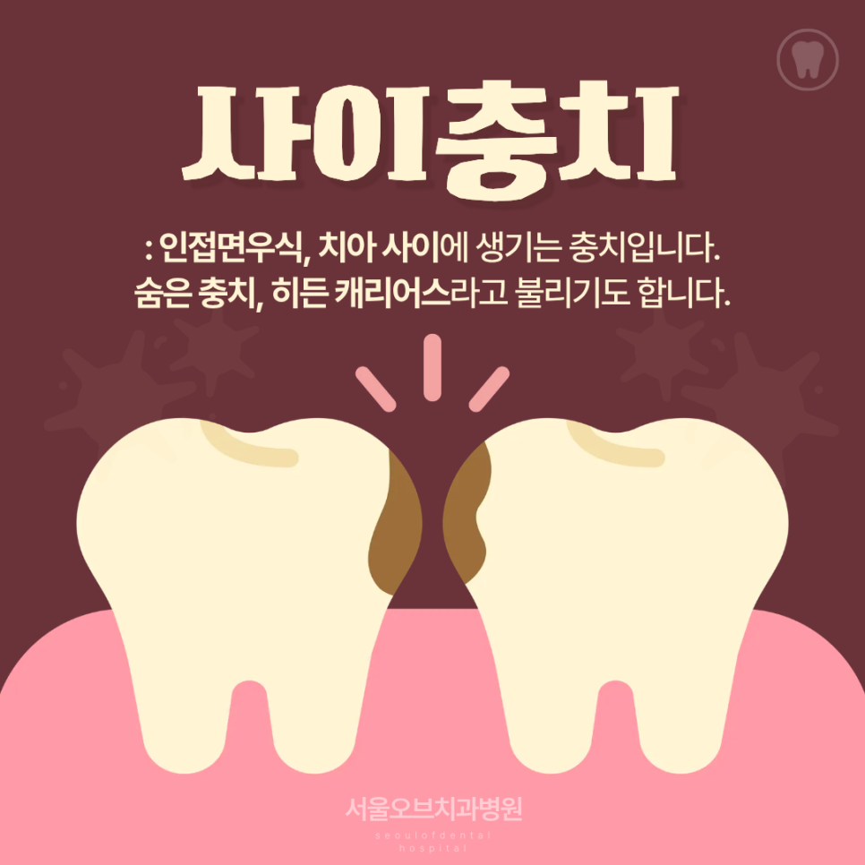 Jamsil Wisdom Tooth Extraction: If It Doesn’t Hurt, Is It Okay to Keep Putting It Off? image 5
