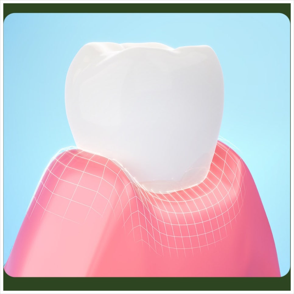 If You Have the Habit of Clenching Your Teeth, Please Fix It! image 3