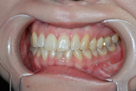 Why Obzero Laminates Look Naturally Beautiful image 11