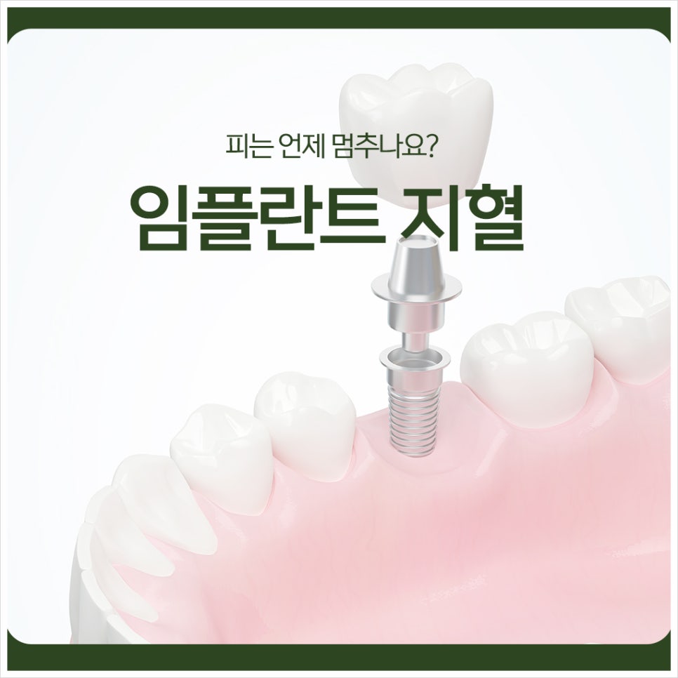 Implant Bleeding Control: When Does the Bleeding Stop? image 1