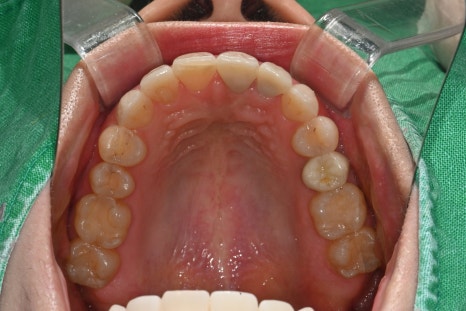 Key Criteria to Know Before Comparing Laminate Prices | OBZERO image 24