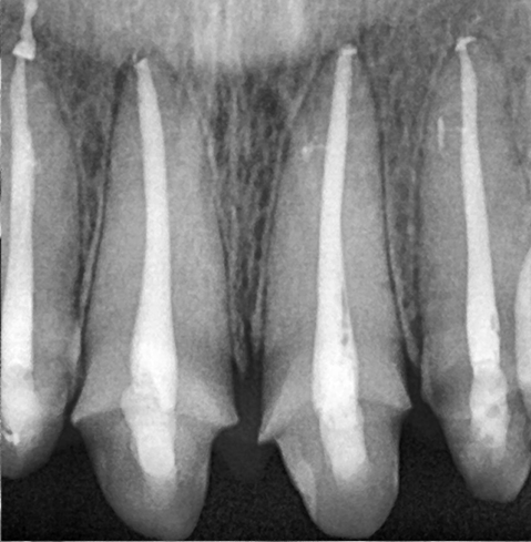[Seokchon Station Dental Clinic] Overcoming Dental Phobia with Evening and Sunday Treatment! image 9