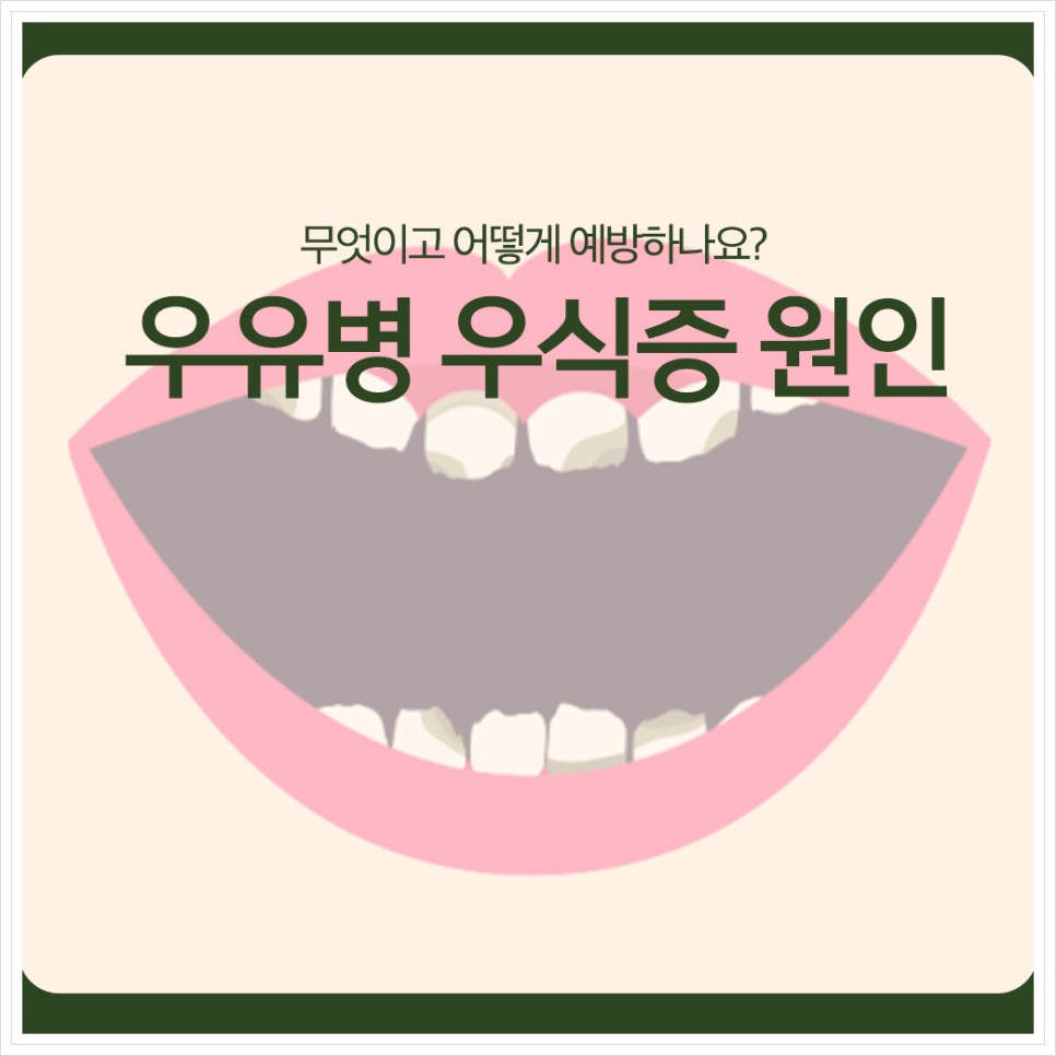 우유병 우식증 원인, 무엇이고 어떻게 예방하나요? 관련 이미지 1