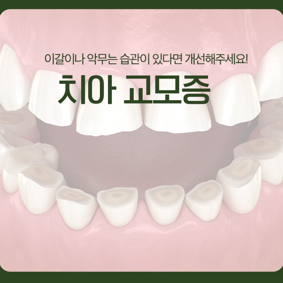 치아 교모증, 이갈이나 악무는 습관이 있다면 개선해주세요! 관련 이미지 1