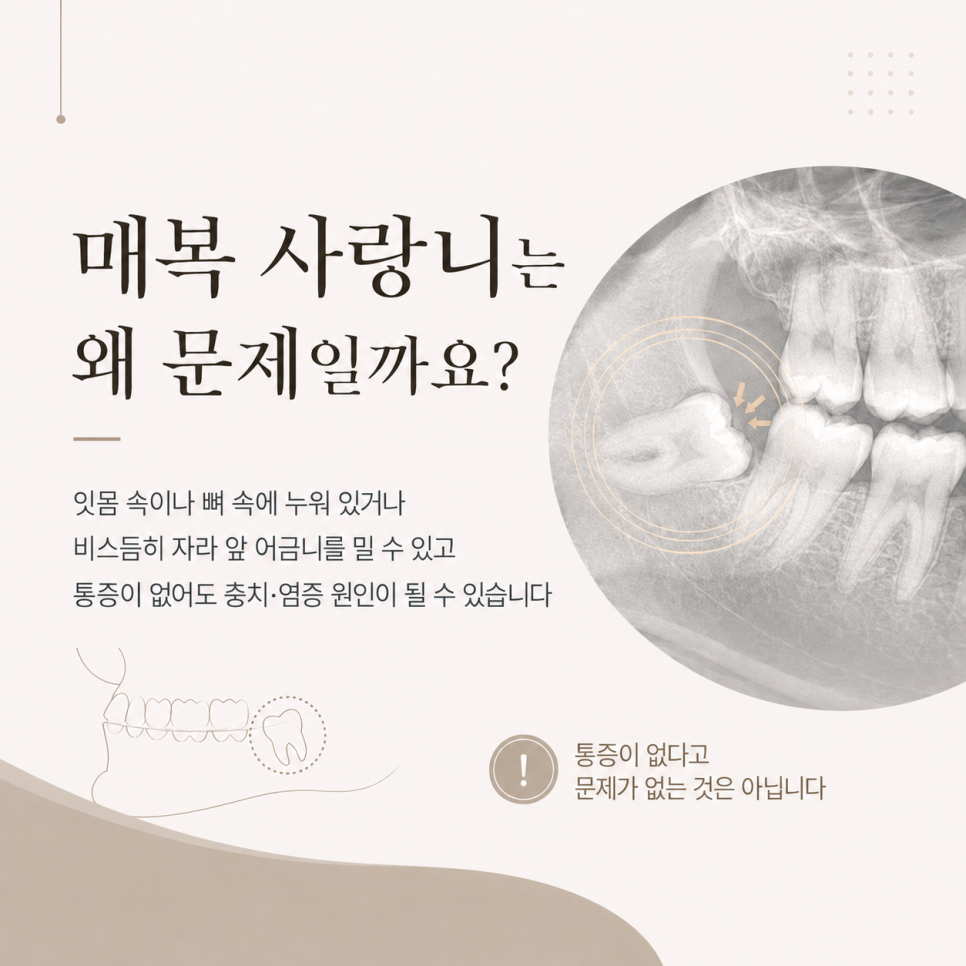 Samjeon Station Dental Clinic: Do Wisdom Teeth Have to Be Removed? Cases Where Extraction Is Necessary image 3