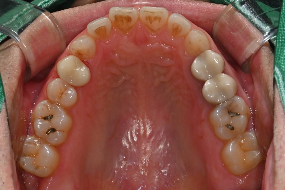 Found a Dental Clinic That Can See Patients on Sundays! Convenient for Patients with Rhinitis and Asthma image 6