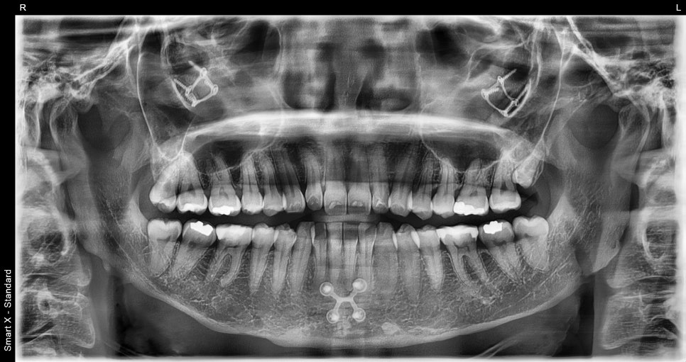 Why Obzero Laminates Look Naturally Beautiful image 3