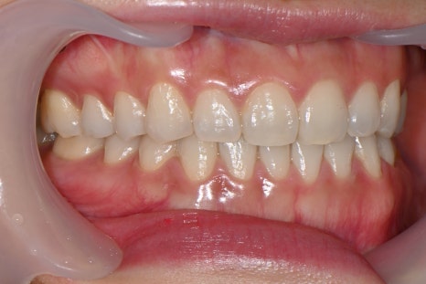 OVZERO Laminate: What Makes It Different? image 6