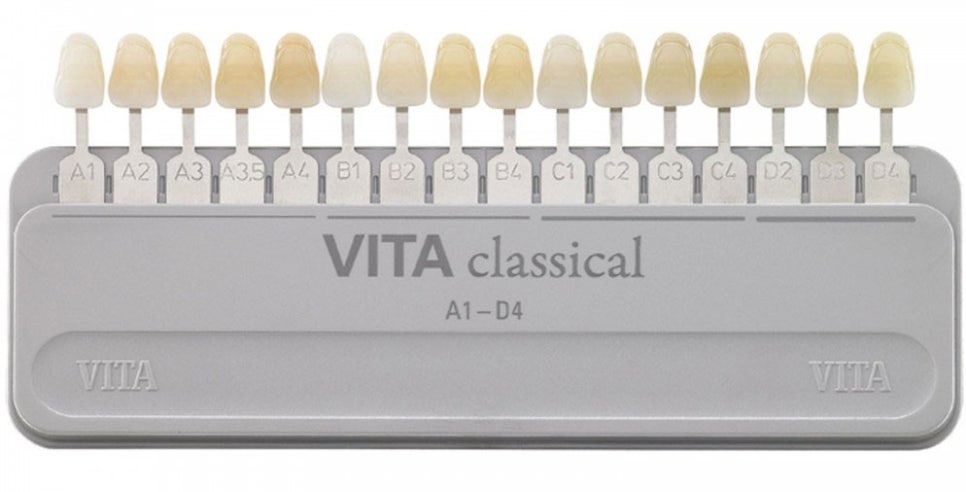 Do Men Get Laminates Too? The Choice of a Man in His 20s Who Became Naturally More Attractive image 1