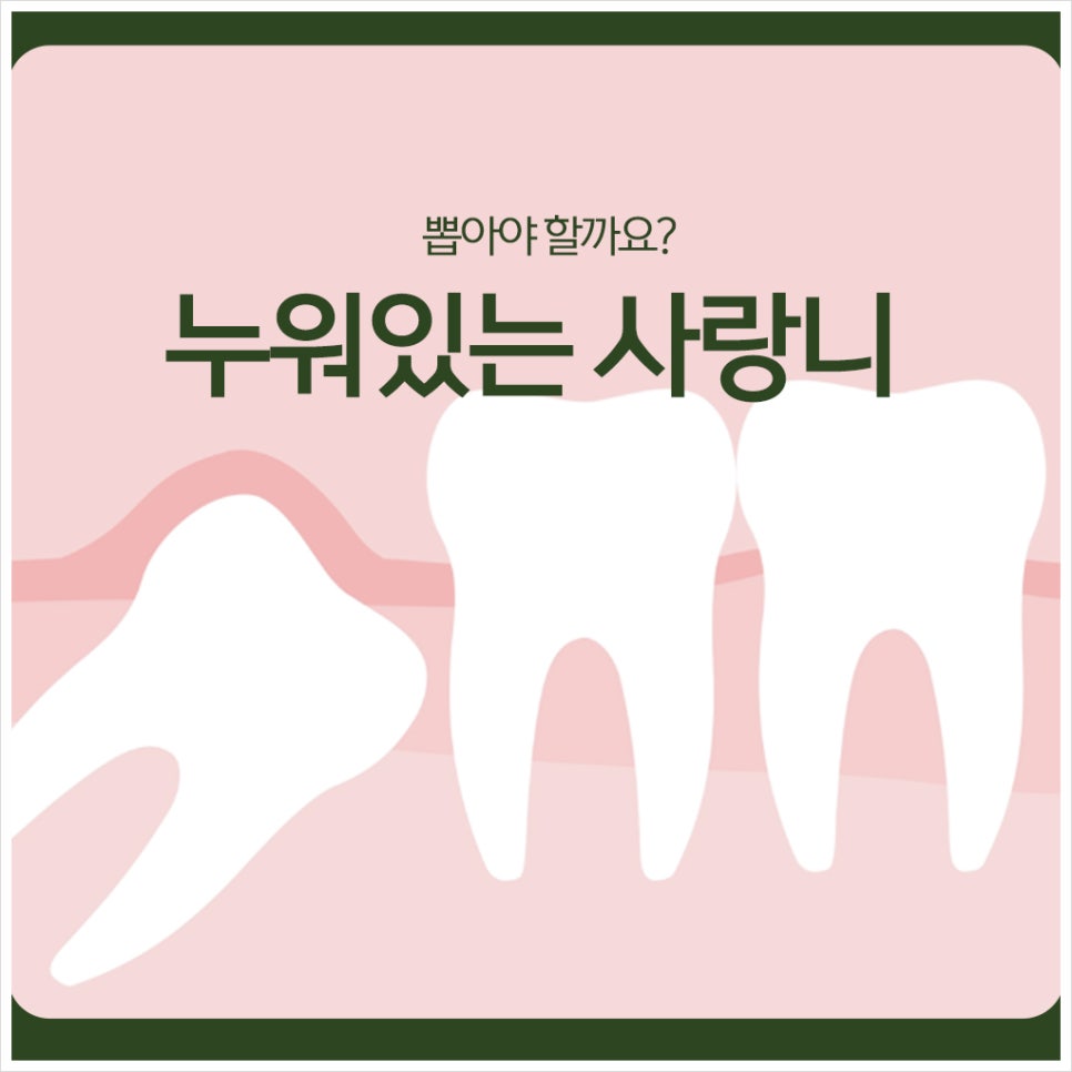 Should a horizontally impacted wisdom tooth be removed? image 1