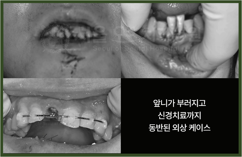 In Unexpected Dental Trauma, There Is a Hospital That Can Respond Immediately image 3