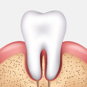Half of Adults Are Leaving It Untreated?! Restore Healthy Teeth with Gum Treatment image 2
