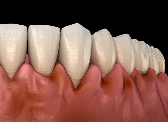 The Power to Protect Natural Teeth: Seoul Orbe Dental Hospital’s Philosophy of Conservative Treatment image 1