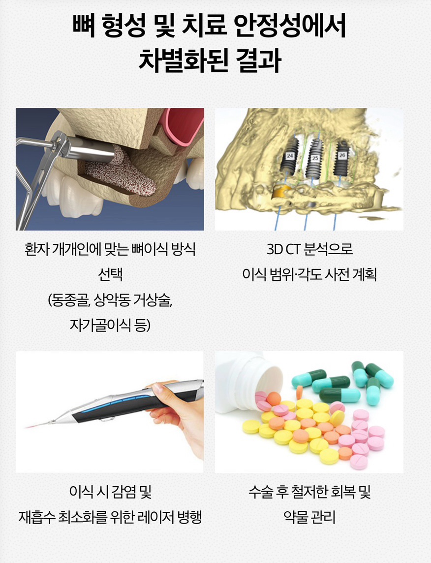 If You’re Considering Same-Day Implants in Jamsil image 5