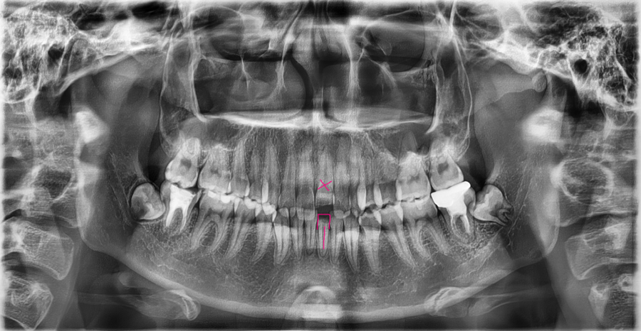 Recommended Ways to Get Hospital Treatment and Compensation After a Traffic Accident image 2