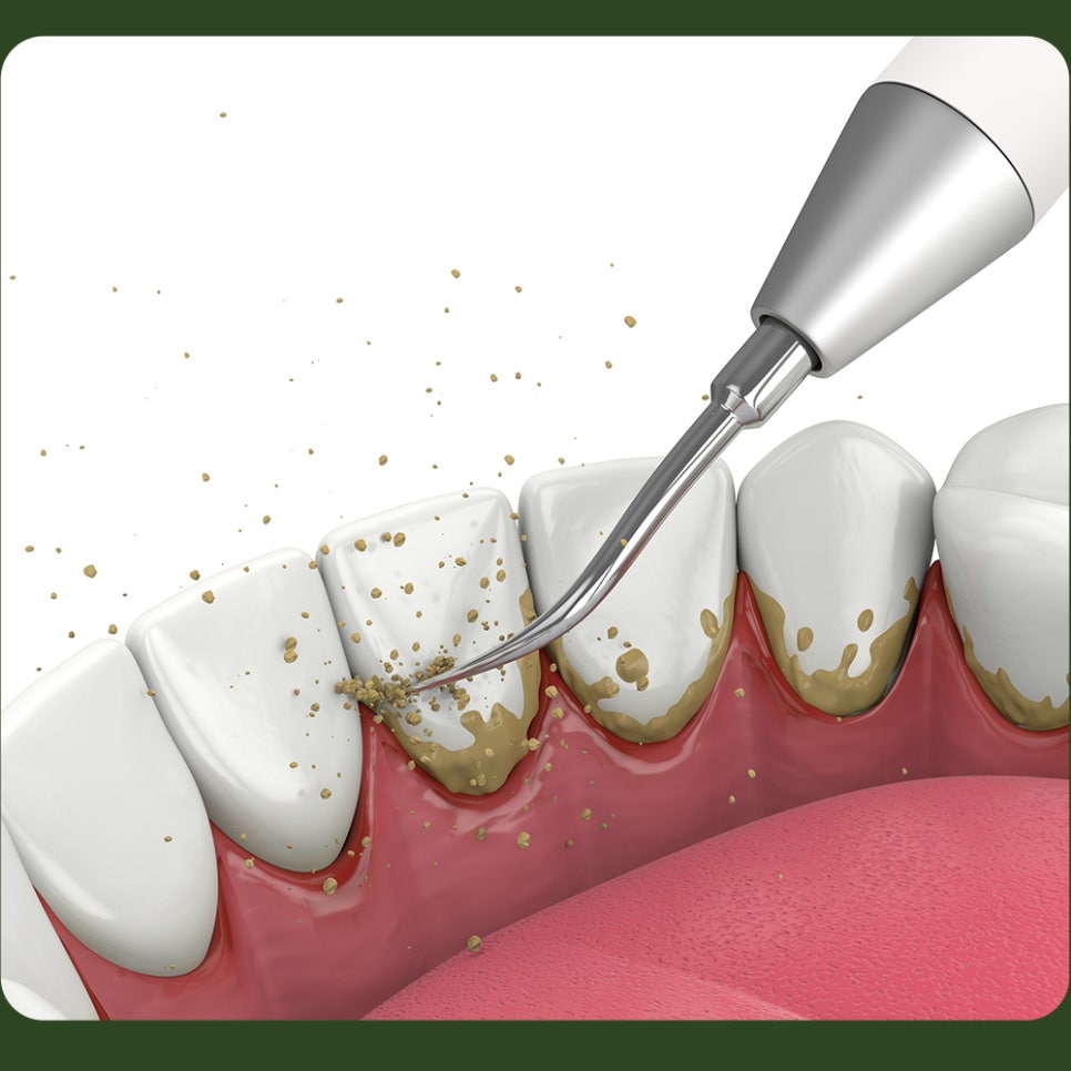 Scaling Frequency: Let’s Learn Together and Keep Up with Regular Visits! image 3