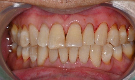 Sedation Dentistry for Those Who Find Scaling Difficult, Seoul Of Dental Hospital image 3