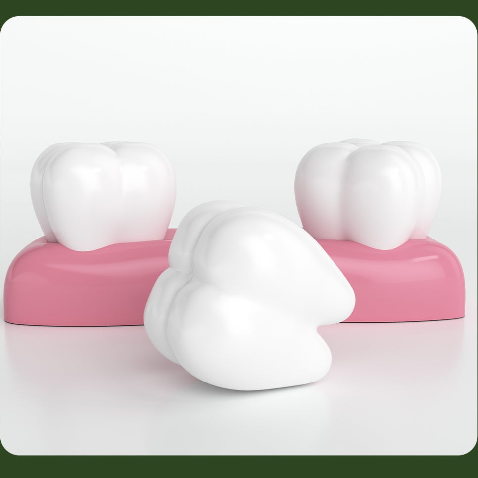 What Causes Tooth Cracks? Why Do They Form? image 5