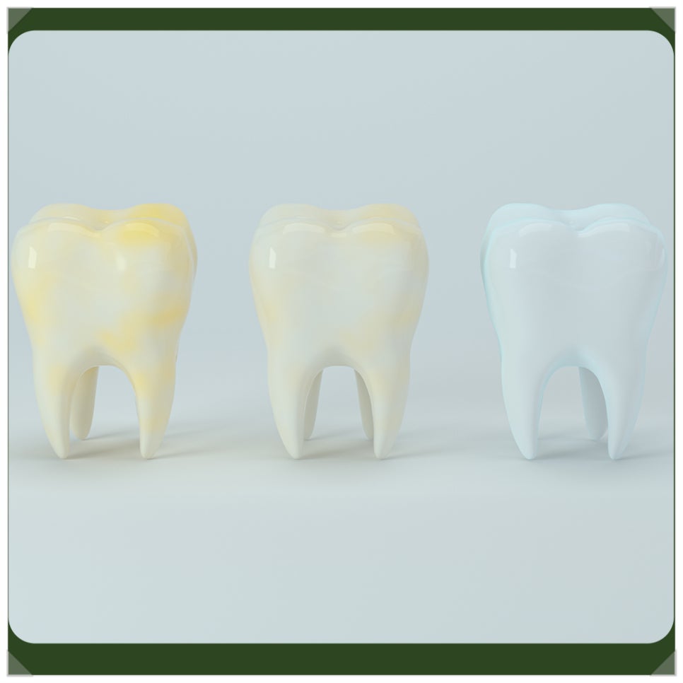 Precautions After Teeth Whitening: Please Be Careful About These Things! image 3