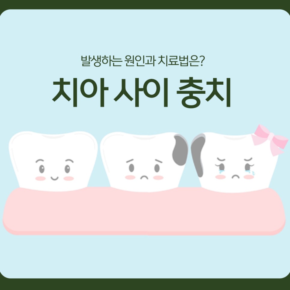 Cavities Between Teeth: What Causes Them and How Are They Treated? image 1