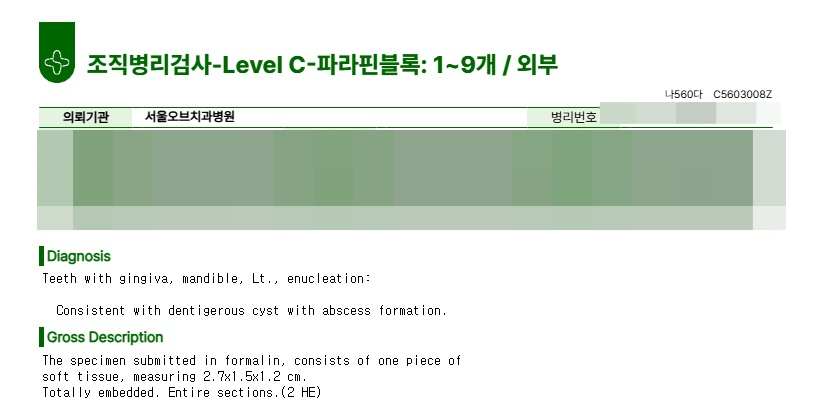 Cysts, If Left Untreated, Can Even Dissolve Bone. Introduction to an Accurate Diagnosis and Surgical Case image 7