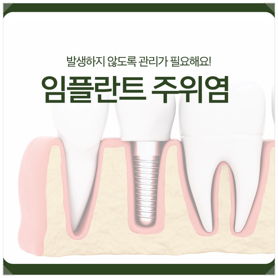 Peri-Implantitis: Proper Care Is Needed to Prevent It! image 1