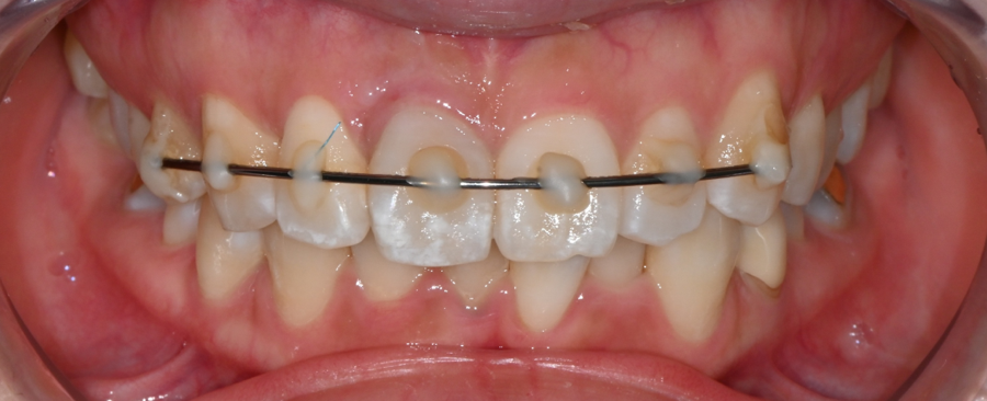 Recommended Ways to Get Hospital Treatment and Compensation After a Traffic Accident image 11