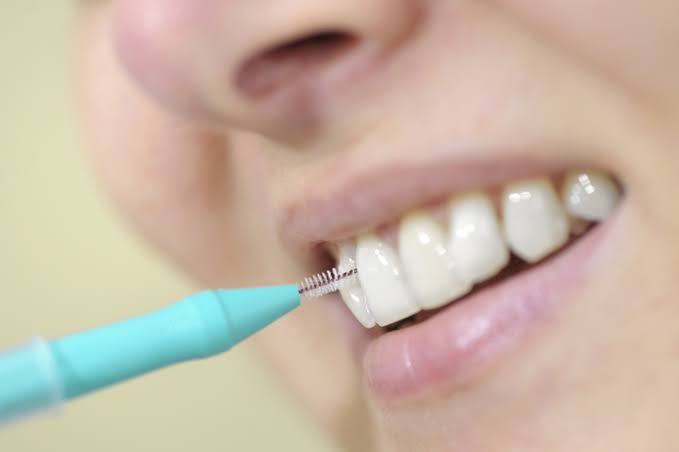 Are You Brushing Your Teeth Properly Every Day? (From Choosing Oral Care Products to How to Use Them) image 5