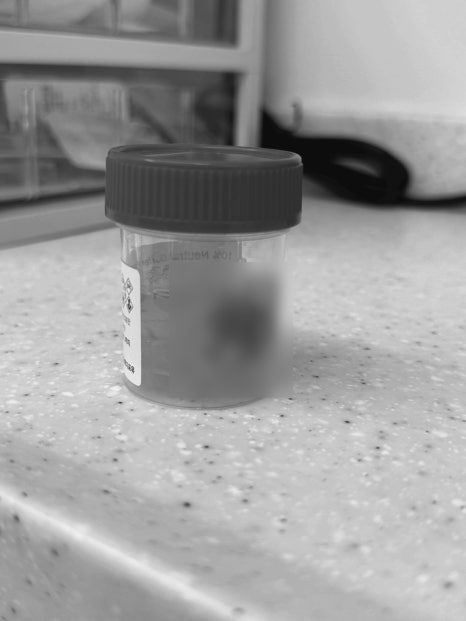 Cysts, If Left Untreated, Can Even Dissolve Bone. Introduction to an Accurate Diagnosis and Surgical Case image 6