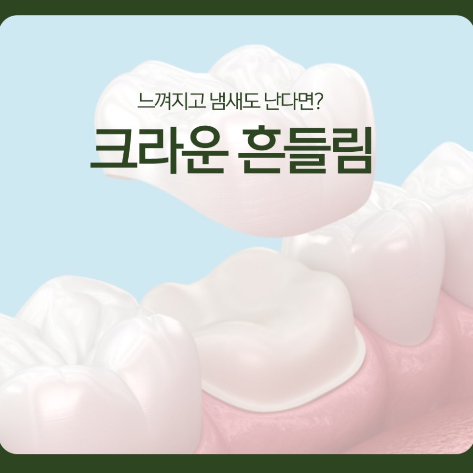 Crown loosening: if you can feel it and there’s a smell, what does it mean? image 1