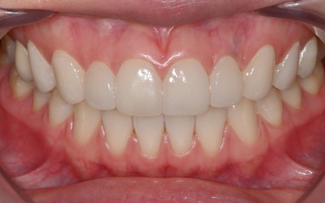 OVZERO Laminate: What Makes It Different? image 10