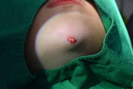 Pediatric Jaw Trauma: Can It Be Treated at a Dental Clinic Instead of a Plastic Surgery Clinic? See the Real Case image 2