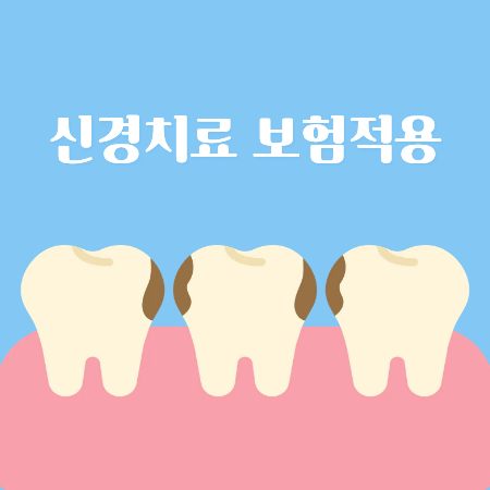 Why Cracked Molar Pain Means You May Need Root Canal Treatment image 6