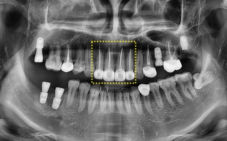 [Seokchon Station Dental Clinic] Overcoming Dental Phobia with Evening and Sunday Treatment! image 16