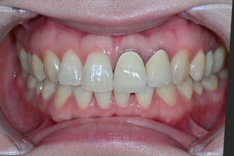 Key Criteria to Know Before Comparing Laminate Prices | OBZERO image 8