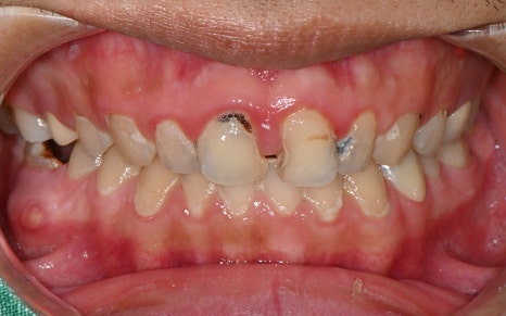 [Seokchon Station Dental Clinic] Overcoming Dental Phobia with Evening and Sunday Treatment! image 3