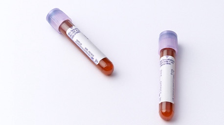 Implant Reoperation: Don’t Give Up. image 7