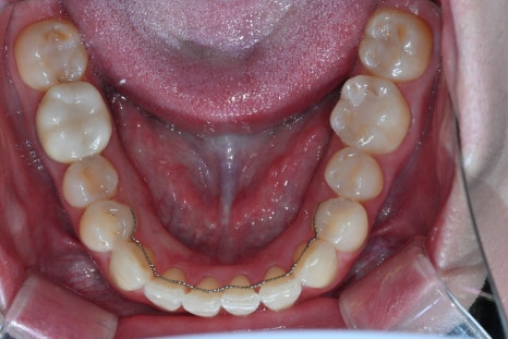 Key Criteria to Know Before Comparing Laminate Prices | OBZERO image 18