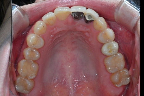 Key Criteria to Know Before Comparing Laminate Prices | OBZERO image 17