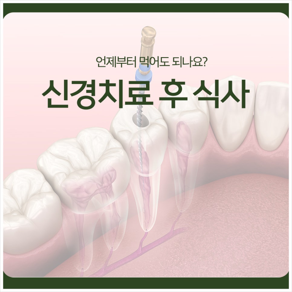 신경치료 후 식사, 언제부터 먹어도 되나요? 관련 이미지 1