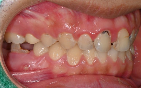 [Seokchon Station Dental Clinic] Overcoming Dental Phobia with Evening and Sunday Treatment! image 2