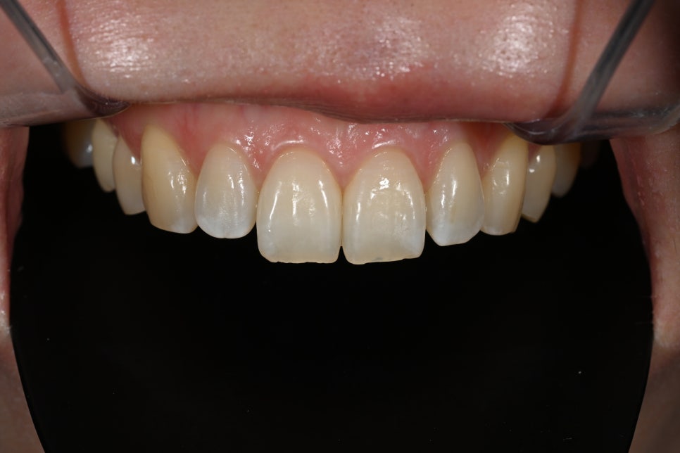 Why Obzero Laminates Look Naturally Beautiful image 16