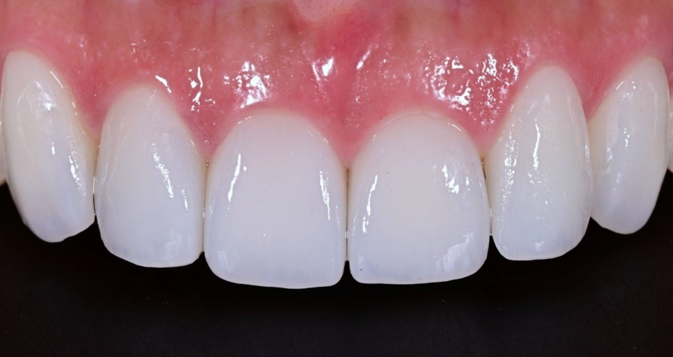 The Money to Open Two Dental Clinics, We Spent It on an ‘In-House Dental Laboratory’ image 4